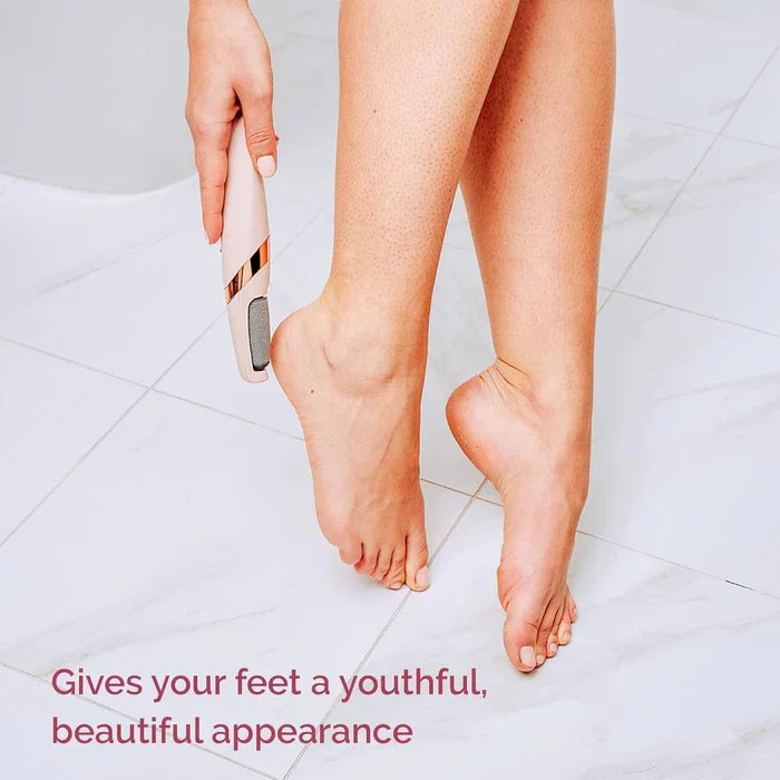 Rechargeable Electric Foot File – Callus Remover for Soft Smooth Feet